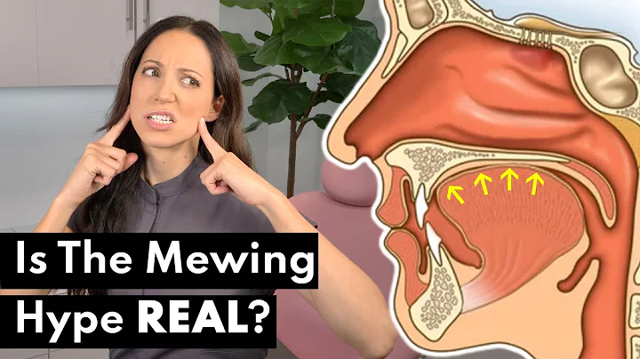 What Is Mewing & Does It ACTUALLY Work?