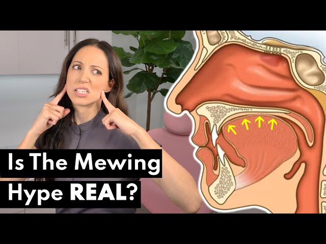 What is mewing jaw?