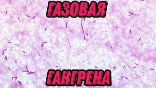 Clostridium perfringens - Газовая гангрена (Анаэробная Раневая Инфекция) / Микробиология