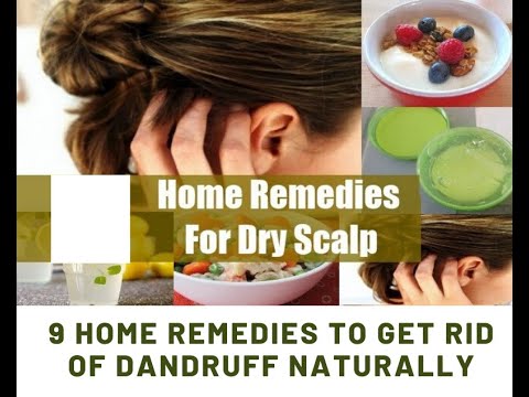 9 Home Remedies to Get Rid of Dandruff Naturally | home remedy for dry scalp