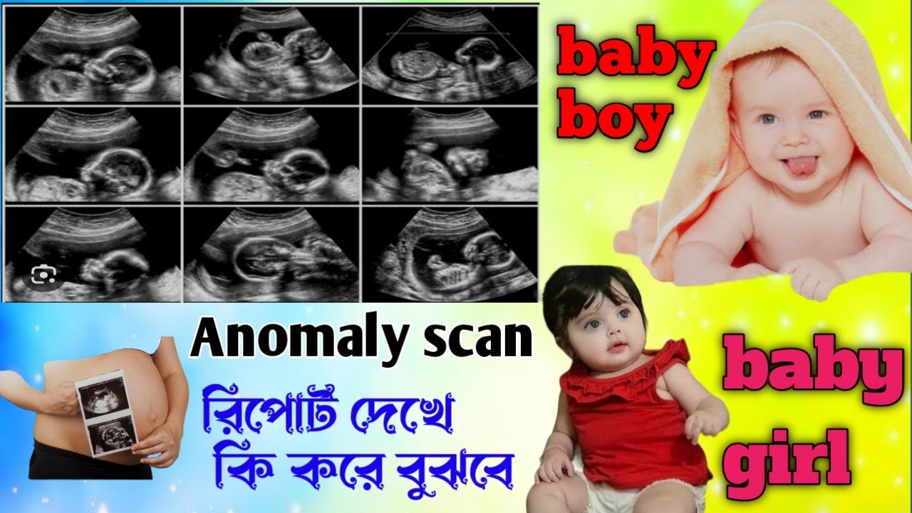 #anomaly||anomaly scan রিপোর্ট দেখে বুঝে নাও  baby boy & baby girl ||#pregnancy