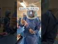 What Severe Hip Arthritis Looks Like #Shorts #HipArthritis #OrthopedicSurgery #HipReplacement