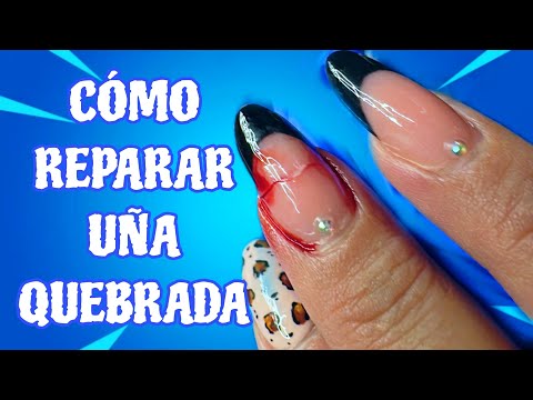 UÑA QUEBRADA/BROKE NAILS