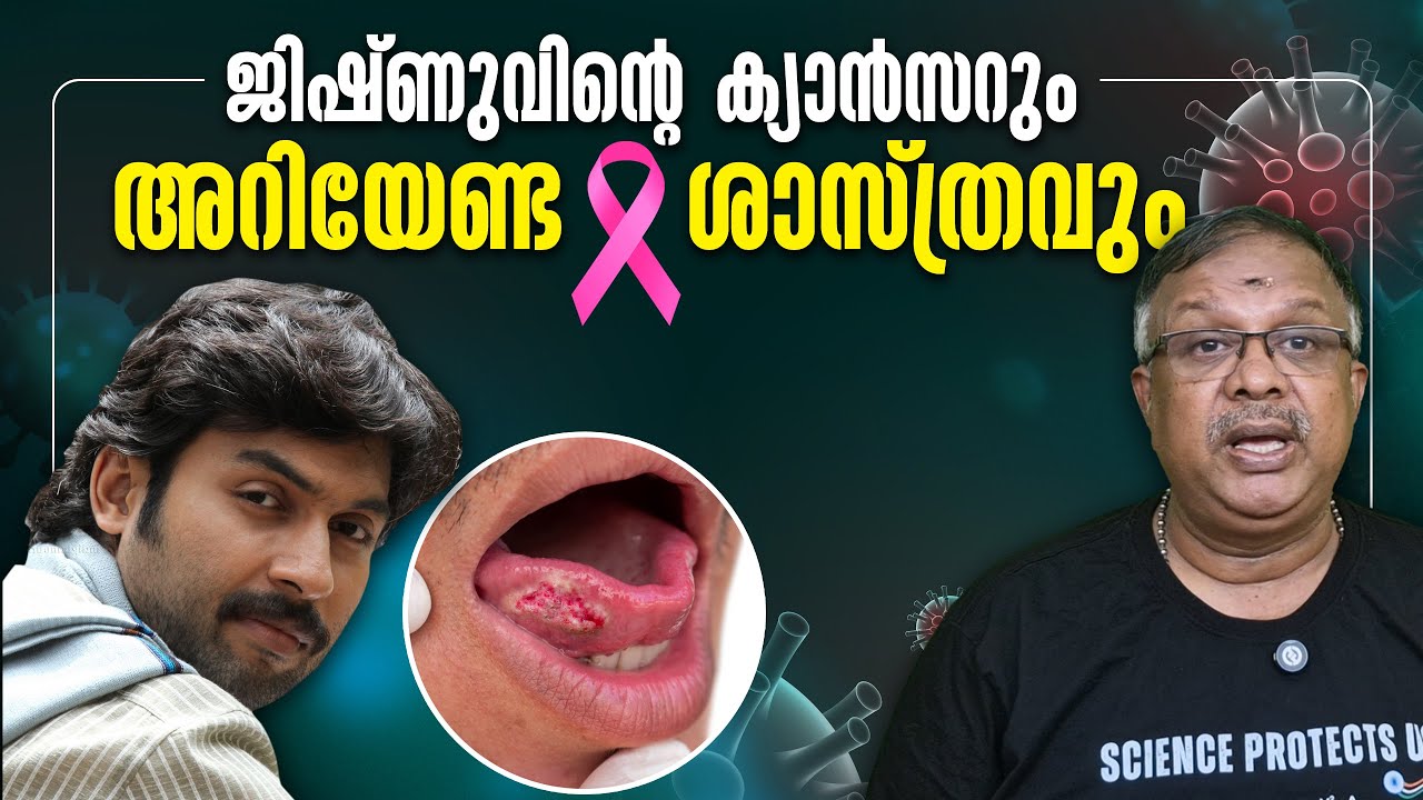 ജിഷ്ണുവിൻ്റെ വായിൽ വന്ന മുറിവും ക്യാൻസറും - what is Cancer | Health Science