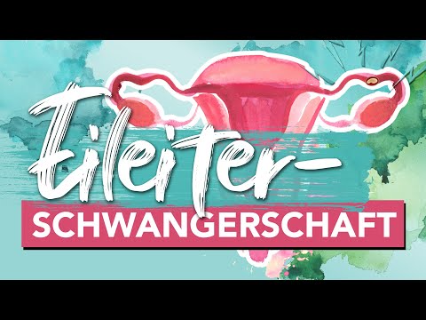 Video: So erkennen Sie eine Eileiterschwangerschaft