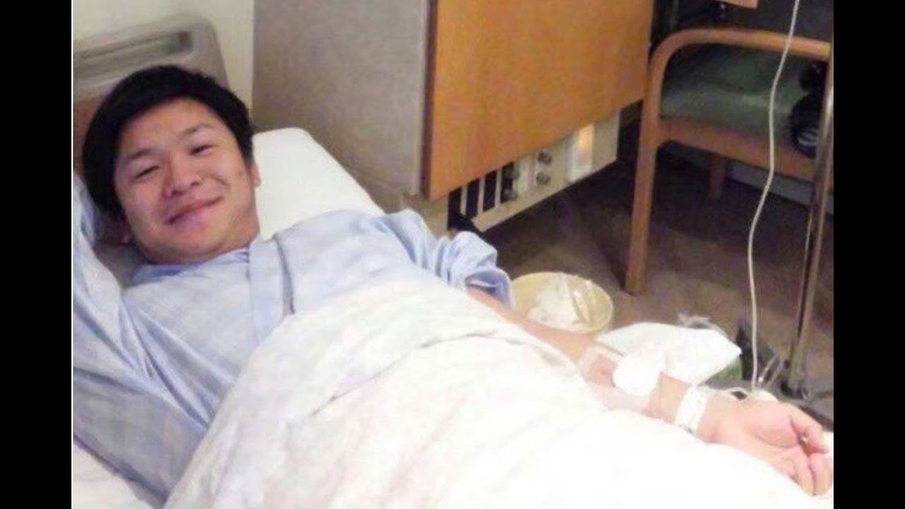 宮迫 胃がん 予兆