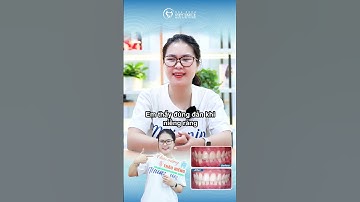 Kết quả xứng đáng sau 2 năm niềng răng . #nhakhoavietsmile  #niengranginvisalign #niengrang