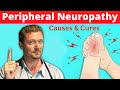 Peripheral NEUROPATHY (Causes and Cures) 2020