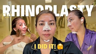 My Rhinoplasty Journey: Before, During, and After Surgery | Anna Magkawas