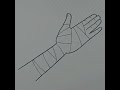 How to draw injured hand shorts