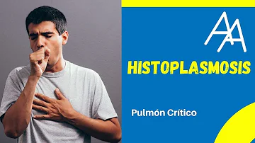 ¿Se puede curar la histoplasmosis?