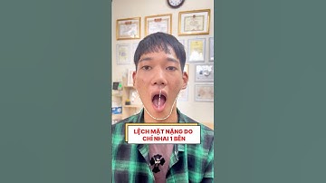 Mặt lệch do nhai 1 bên. #matlech #hungtrilieu #nanmat