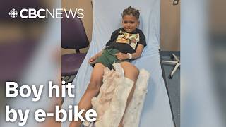 Steinbach mom wants more restrictions on e-bikes after son hit, suffers broken leg