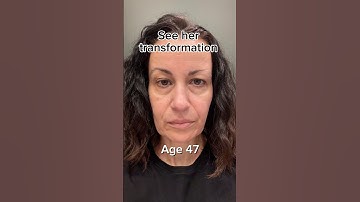 Facelift Naturally | Face Fitness | Face Yoga | Face Massage