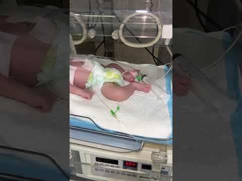 قلوبنا معلقة بأول ضحكة أو بكاء من يحيى الصغير احضرو الفيديو للأخير اكسبلور