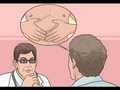 Que es una hernia estrangulada