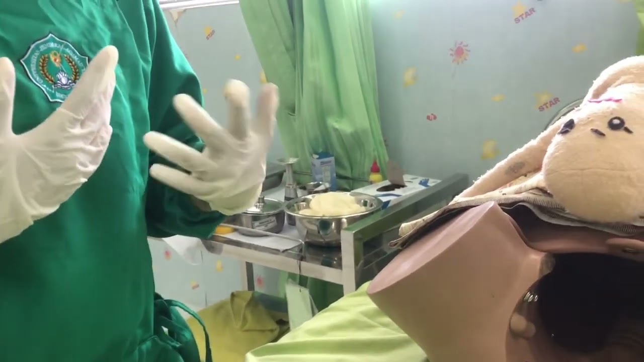 Video Persalinan Sungsang ( Tekhnik Brach Spontan , Muller & Klasic )