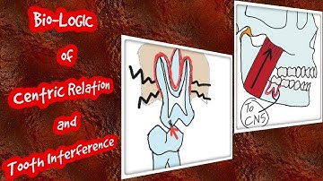 Bio-LOGIC behind Centric Relation and Tooth Interference// Muscle Engrams