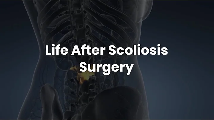 Life After Scoliosis  Surgery | Recovery After Scoliosis Surgery - Lyboat