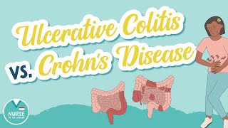 Ulcerative Colitis vs. Crohn's Disease - Know the Difference | Med Surg Help for Nursing School