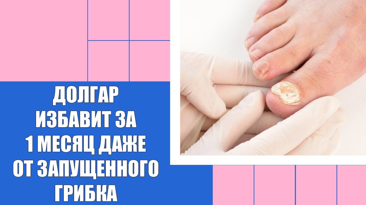 Лечение грибка эффективное