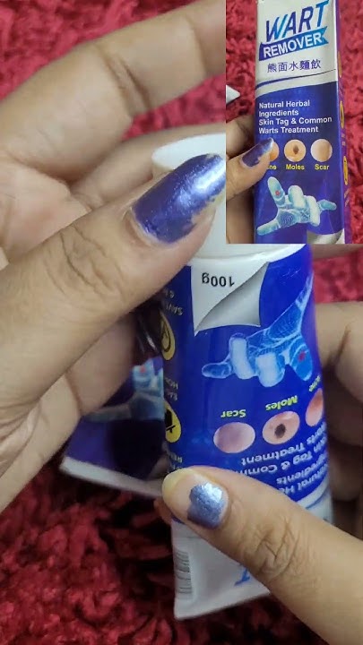 best-wart-removal-cream-how-quickly-does-wart-remover-work-youtube