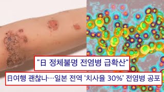 일본을 덮친 치사율 30% 전염병, 진실을 알아봤습니다.