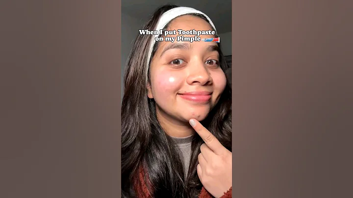 🦷 Toothpaste on Pimples?! #skincare #shorts