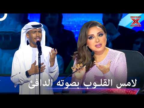شجن وإحساس دافئ.. أمير يغني بشغف وشيماء تؤكد مكانتها في القمة - اكس فاكتور الموسم 1