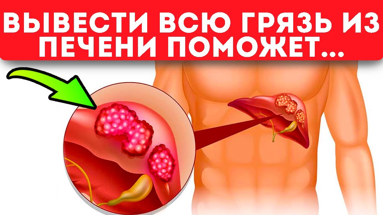 здоровая печень картинки. масло для очистки печени. видео чистки печени. очищение организма печени. как свеклой очистить печень.