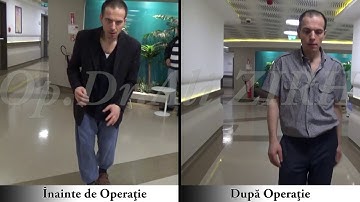 Orhan OZCAN / Înainte şi După Operaţie