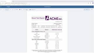 Introducing the JSViewer | ActiveReports