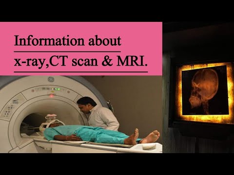 x ray | CT scan | MRI | details by Encyclopedia World