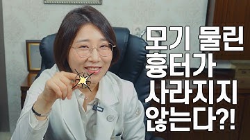 모기 물린 흉터가 사라지지 않는다?! 상처자국 듀오덤