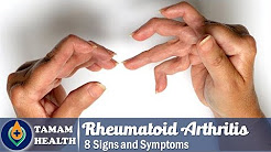 8 Symptoms of Rheumatoid Arthritis | Signs  of Rheumatoid Arthritis