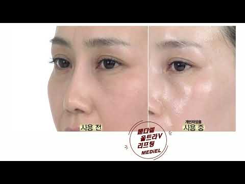 메디엘 울트라V리프팅 세럼 Mediel Ultra V Lifting Serum
