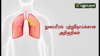 நுரையீரல் புற்றுநோய்க்கான அறிகுறிகள் | Lung Cancer | Dr.கௌதமன் | PuthuyugamTV