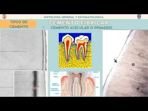 Qué es un cemento dental - Reformas Sabadell