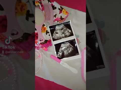 سكره سكره بنوته حلوه صغيره تحضيرات بيبي كيوت