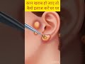 कान का इलाज कैसे करें 3D वीडियो#reels #asmr #trending #3d🌅 #shortsvideo