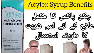 Acylex Syrup Benefits || Acylex 60ml Syrup Uses and Side Effects | chicken pox | hearpes simplex