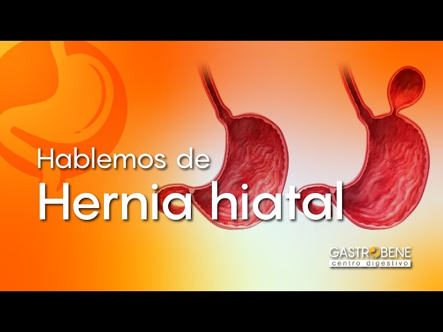 Hernia Hiatal - Gastrobene