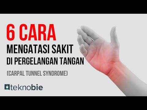 6 Cara Mengatasi Sakit di Pergelangan Tangan (Carpal Tunnel Syndrome)