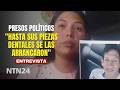 "Hasta sus piezas dentales se las arrancaron": familiar de preso acusado de atentado contra Maduro