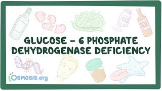 Glucose-6-phosphate dehydrogenase deficiency