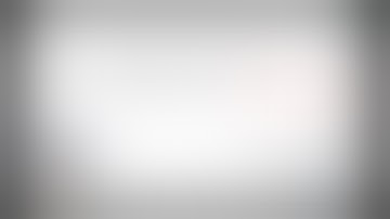 Negotiating the Difficult - Lap Simple Nephrectomy "Not that Simple" - Dr Nitesh Jain, Chennai