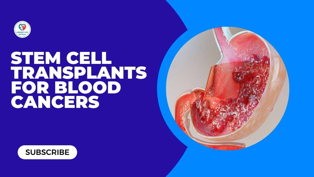 Unlocking Life Understanding Stem Cell Transplants for Blood Cancers