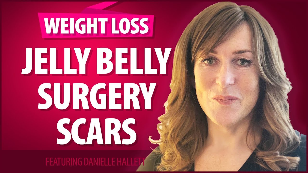 Arm lift surgery scars Squishy seroma after tummy tuck YouTube