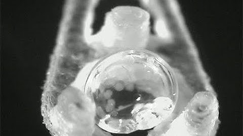 Cryopreservation of pancreatic islet cells