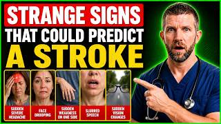 Hidden Stroke Symptoms That Often Appear Days Before Disaster